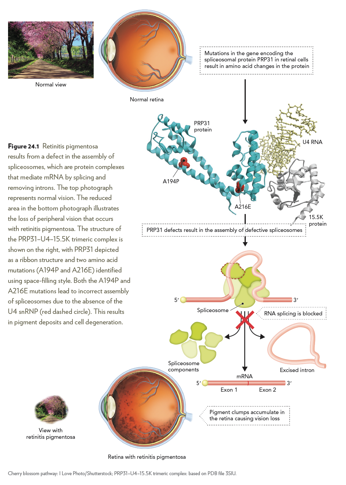 Biochem Splicing RNA Splicing Defects and Blindness – Everyday BioChem
